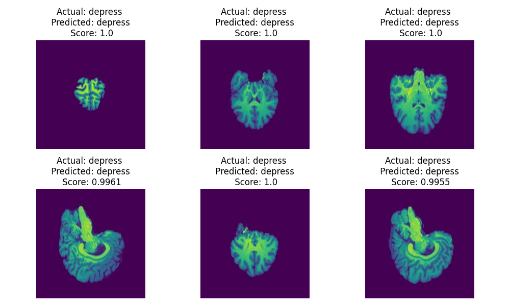 Prediction done on some of the images from a depressive subject